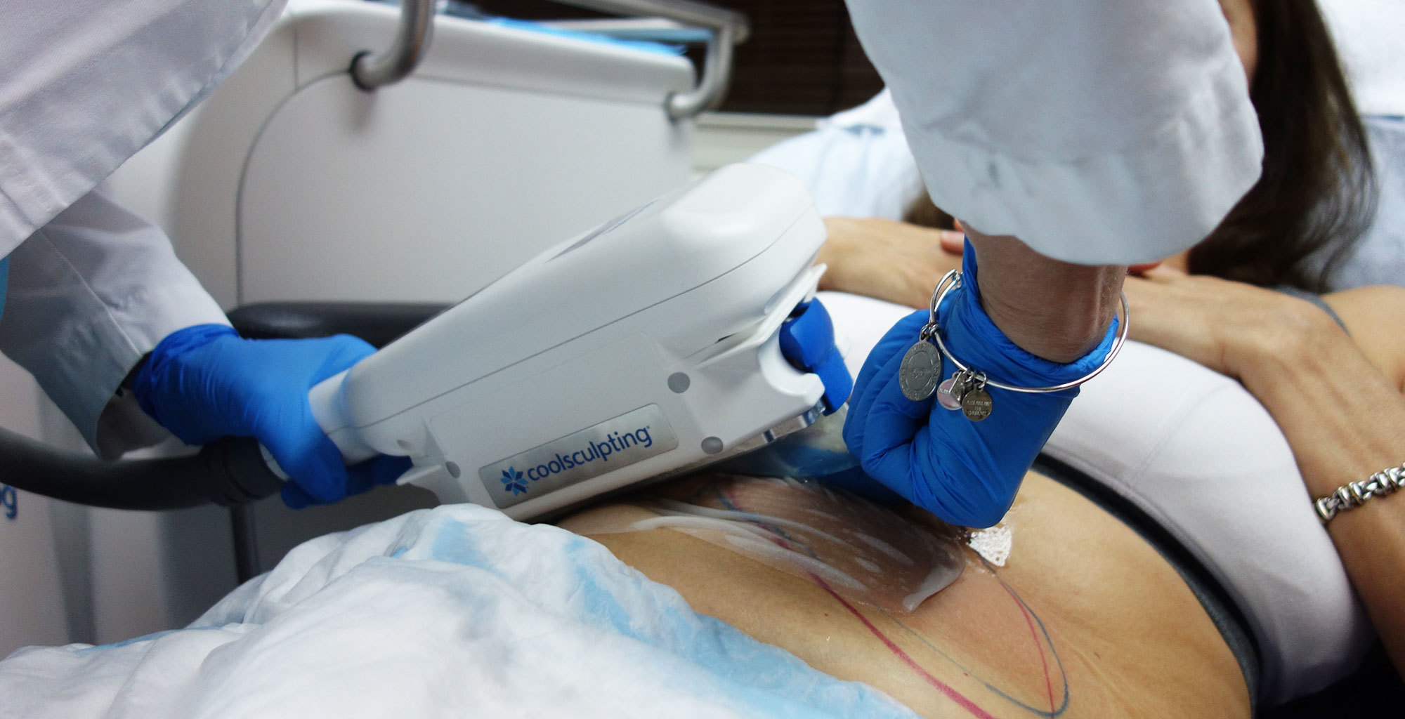 A Patient Journey with Coolsculpting® - Dermetics